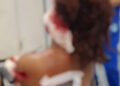Mulher é atacada com garrafa quebrada e sobrevive a tentativa de feminicídio Mulher é atacada com garrafa quebrada e sobrevive a tentativa de feminicídio