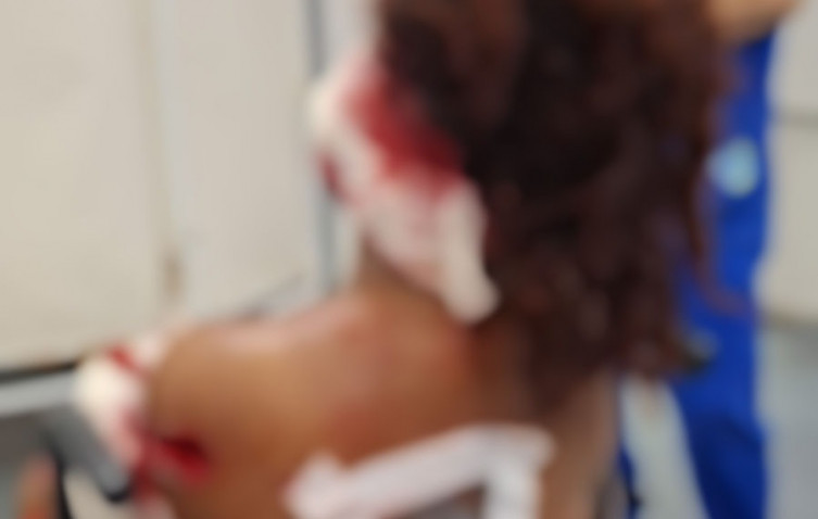 Mulher é atacada com garrafa quebrada e sobrevive a tentativa de feminicídio