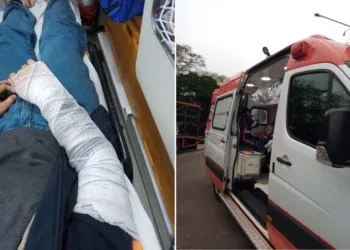 Acidente deixa motociclista com fratura no punho