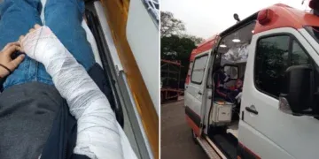 Acidente deixa motociclista com fratura no punho