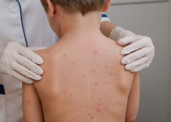 Alerta de meningite mobiliza autoridades e comunidade em Campo Grande Alerta de meningite mobiliza autoridades e comunidade em Campo Grande