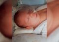 Bebê de 1 mês enfrenta grave alergia e segue internada em Campo Grande