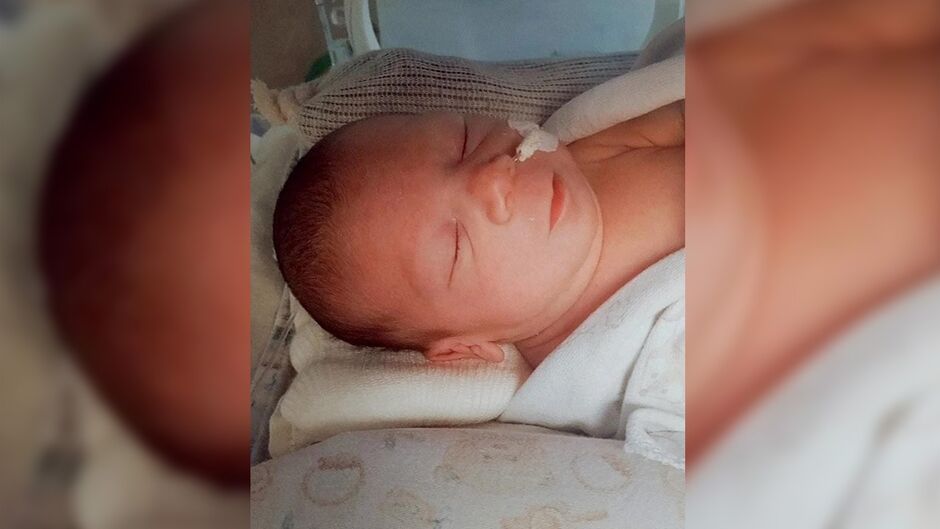 Bebê de 1 mês enfrenta grave alergia e segue internada em Campo Grande