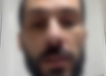 Em vídeo homem queimado defende esposa presa e afirma: “Ela não teve intenção de me matar” Em vídeo homem queimado defende esposa presa e afirma: “Ela não teve intenção de me matar”