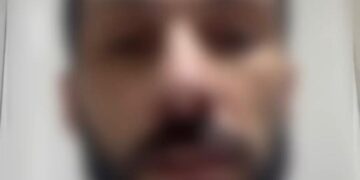 Em vídeo homem queimado defende esposa presa e afirma: “Ela não teve intenção de me matar”