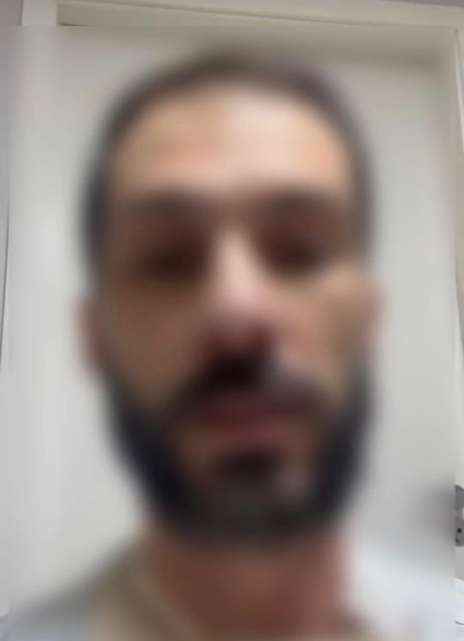 Em vídeo homem queimado defende esposa presa e afirma: “Ela não teve intenção de me matar”