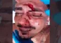 Briga em festa termina com jovem ferido por garrafa Briga em festa termina com jovem ferido por garrafa