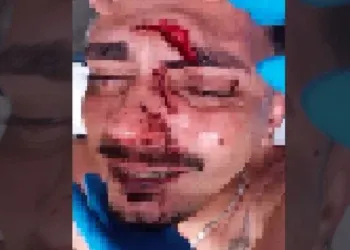 Briga em festa termina com jovem ferido por garrafa Briga em festa termina com jovem ferido por garrafa
