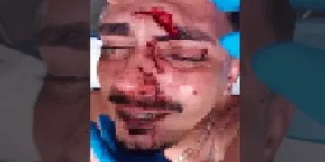 Briga em festa termina com jovem ferido por garrafa