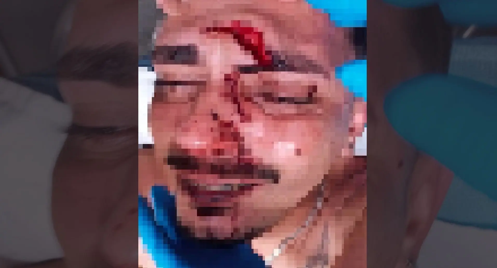 Briga em festa termina com jovem ferido por garrafa