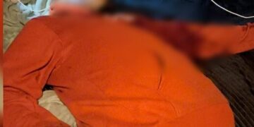 Homem fica gravemente ferido após ser atacado com golpes de faca