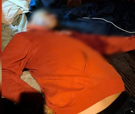 Homem fica gravemente ferido após ser atacado com golpes de faca